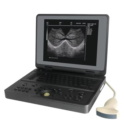 Digitalt ultralydbildesystem